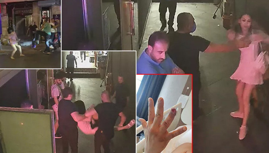 Eğlence mekanında güvenliğin parmağını koparmıştı İşte istenen ceza