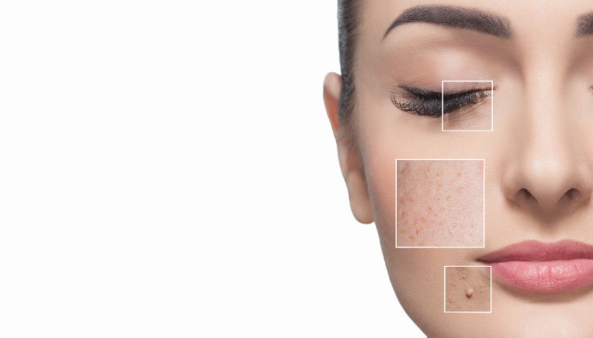 Kış aylarında lekeler kendini belli eder