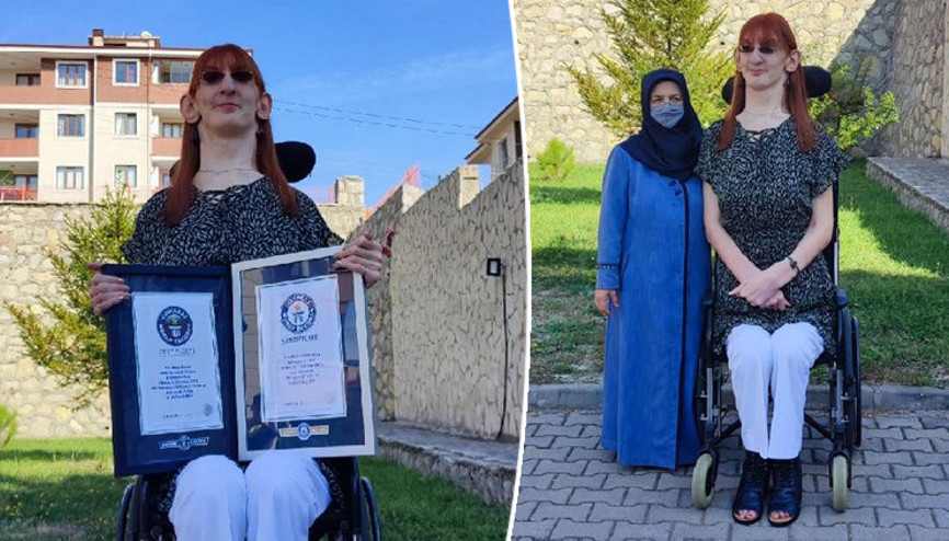 Dünyanın en uzun kadını Rumeysadan ilk açıklama