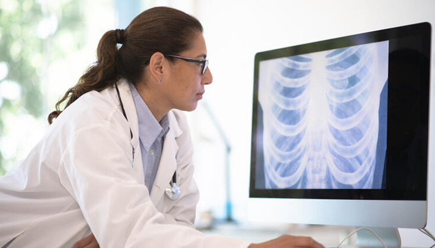 Tüberküloz (Verem) nedir, nasıl bulaşır İşte tüberküloz hastalığı belirtileri ve tedavisi hakkında ayrıntılar