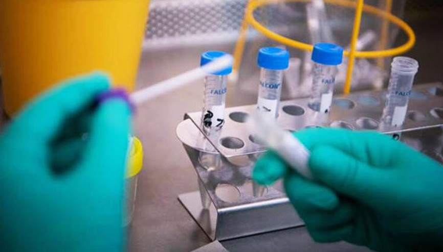 Koronavirüs test sonucu ne zaman çıkar, PCR test sonucu daha mı hızlı çıkıyor İşte Kovid-19 testleri ile ilgili merak edilenler