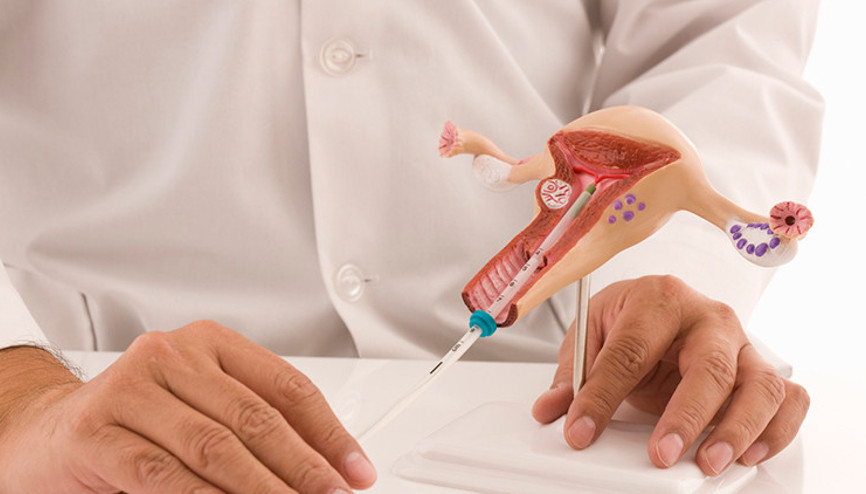 Labioplasti Nedir, Kimlere Yapılır Labioplasti Ameliyatı Hakkında Merak Edilenler Labioplasti Nedir, Kimlere Yapılır Labioplasti Ameliyatı Hakkında Merak Edilenler