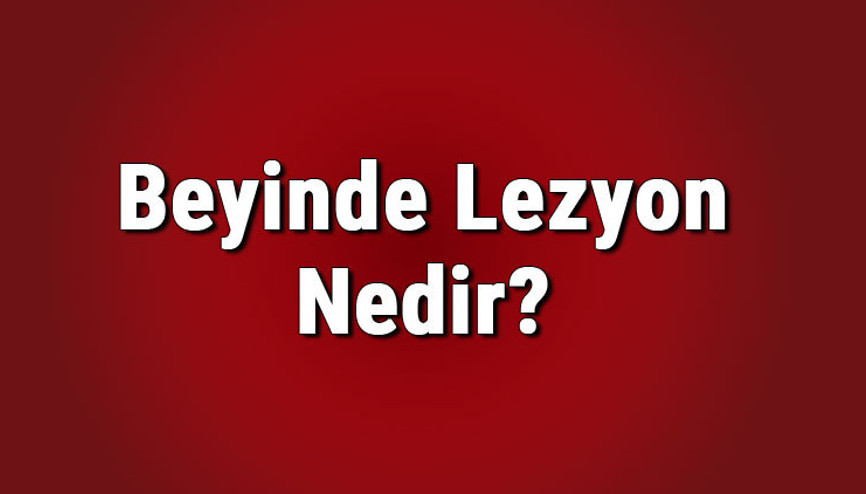 Beyinde lezyon nedir Lezyon tümör müdür, kanser midir Lezyon çeşitleri nelerdir