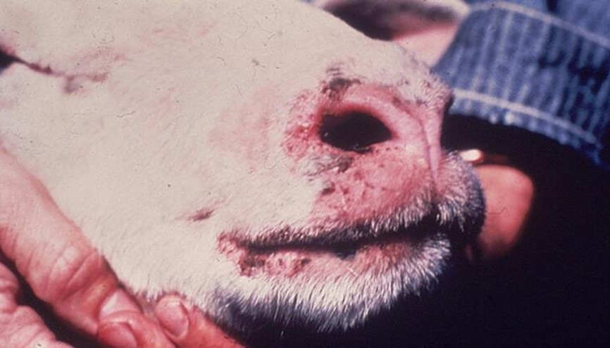 Mavi dil hastalığı nedir, belirtileri neler