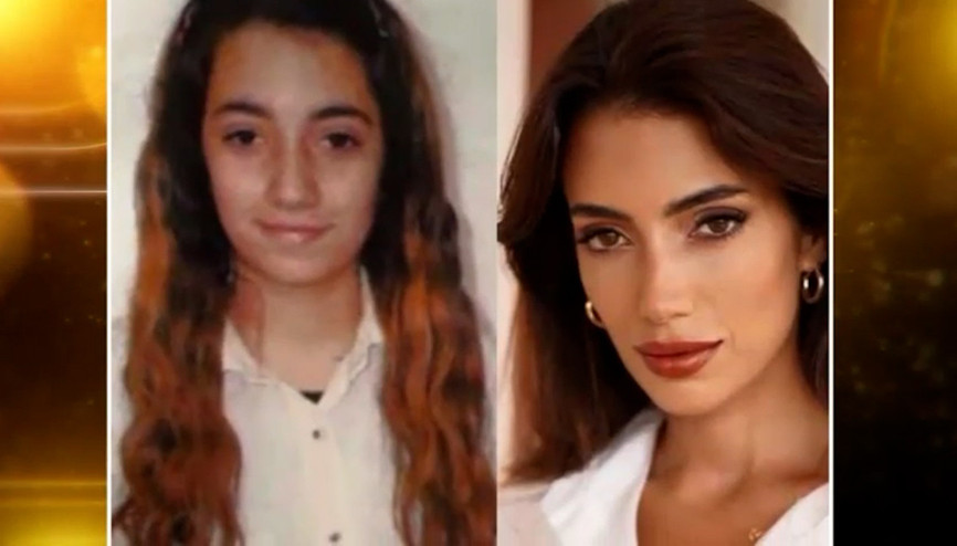 Rachel Araz estetik iddialarına ilk kez “teve 2 Magazin Masası”nda cevap verdi…