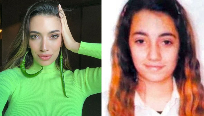 Rachel Araz estetik iddialarına ilk kez “teve 2 Magazin Masası”nda cevap verdi…