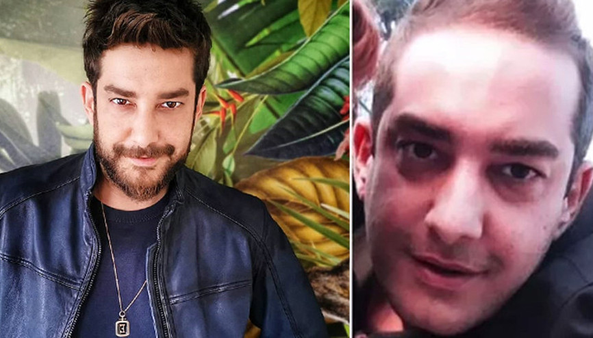 Enis Arıkandan estetik itirafı