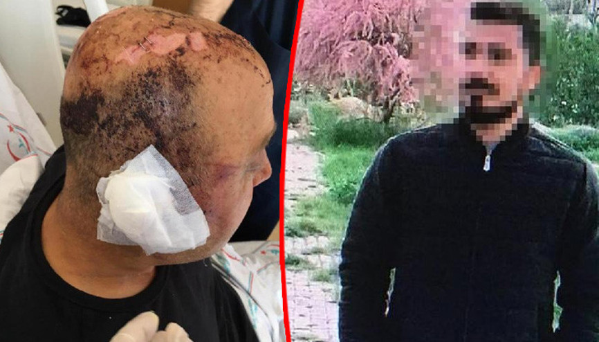 Polisi telsiziyle öldüresiye dövmüştü İşte istenen ceza