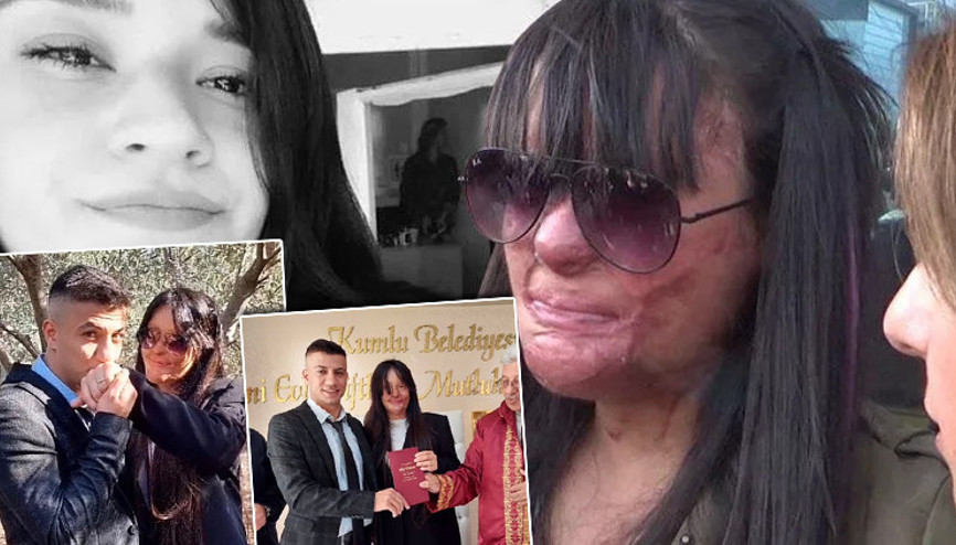 Türkiye günlerce Berfin Özeki konuşmuştu Yüzüne asit atan erkek arkadaşıyla evlendi