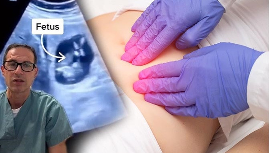 Tıp dünyasını şaşırtan hamilelik Rahimde değil karaciğerde… Nasıl olur 6 SORU 6 YANIT