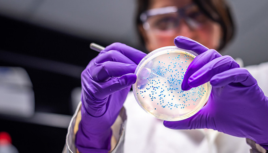 Korkutan uyarı: Çiftliklerde antibiyotik kullanımı Kovid’den çok daha büyük bir salgına yol açabilir Korkutan uyarı: Çiftliklerde antibiyotik kullanımı Kovid’den çok daha büyük bir salgına yol açabilir