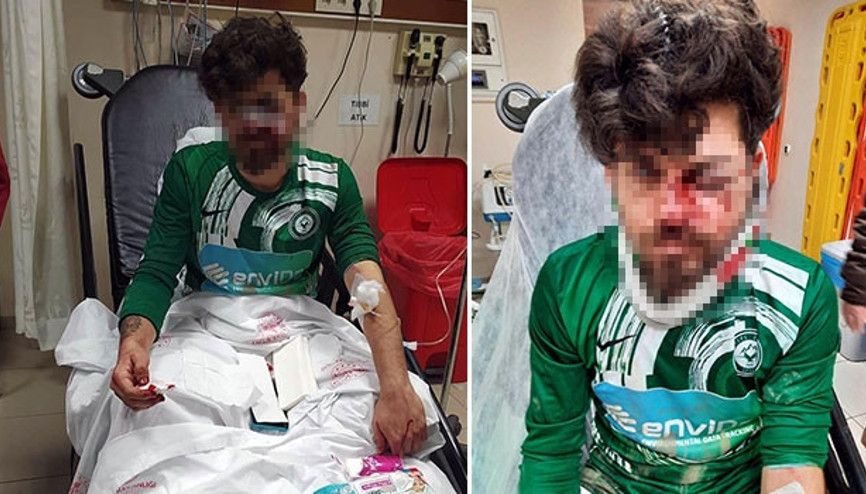 Yerde yatan rakibinin yüzüne tekme atıp yaraladı