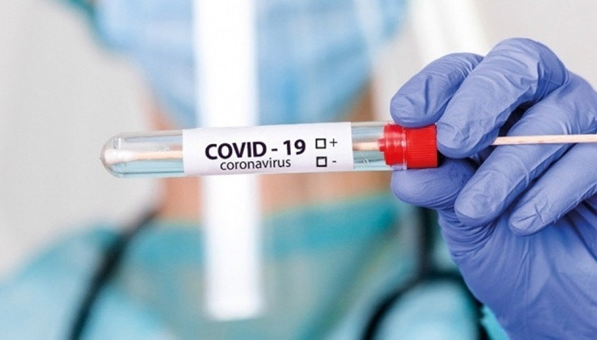 Covid 19 test sonucu ne zaman çıkar İşte PCR test sonuçları hakkında bilgiler