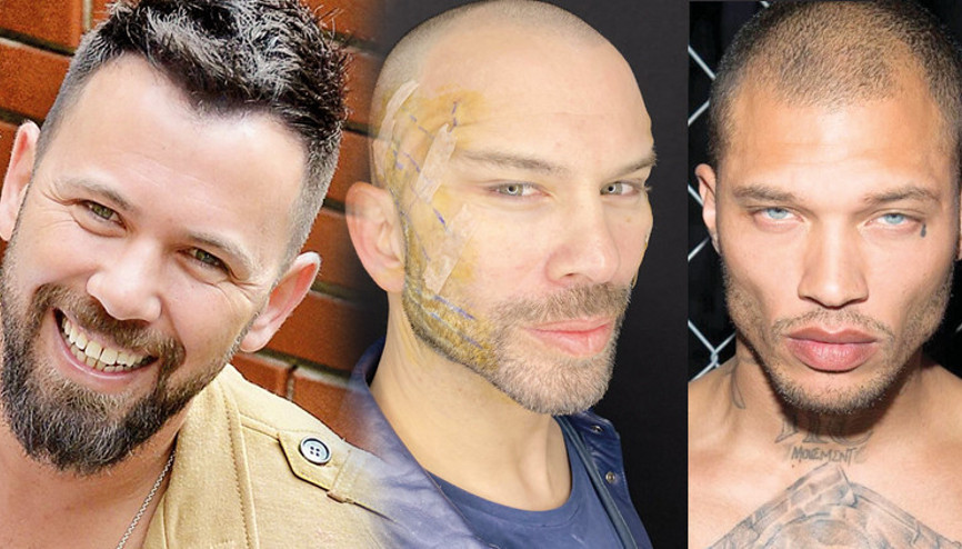Berksan ameliyatla Jeremy Meeks oldu