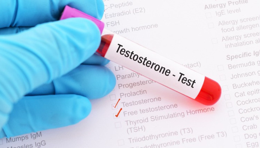 Mutluluğun anahtarı: Testosteron Mutluluğun anahtarı: Testosteron