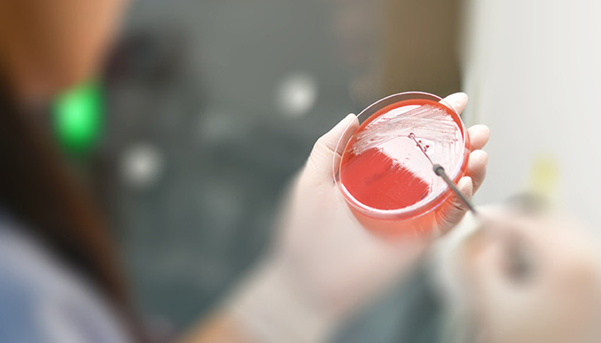 Korkunç bilanço: Her gün 3 bin 500 insan bu sebeple ölüyor Korkunç bilanço: Her gün 3 bin 500 insan bu sebeple ölüyor