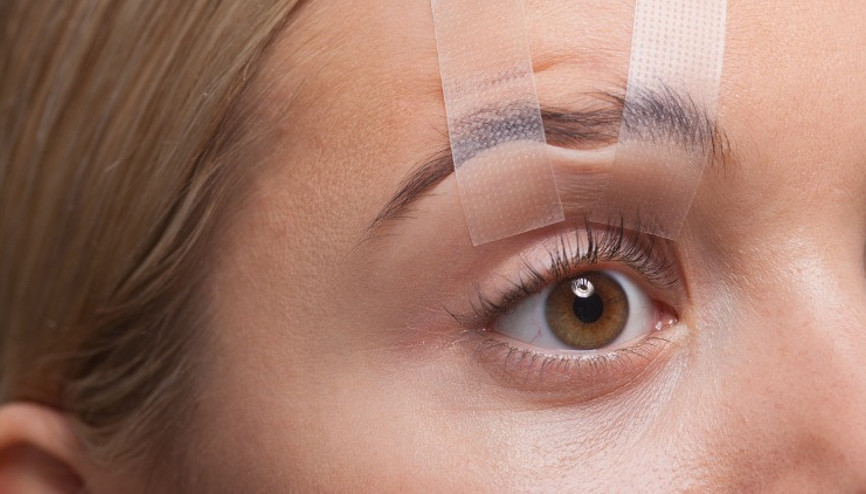 Göz Kapağı Estetiği (Blefaroplasti) Nedir, Nasıl Yapılır