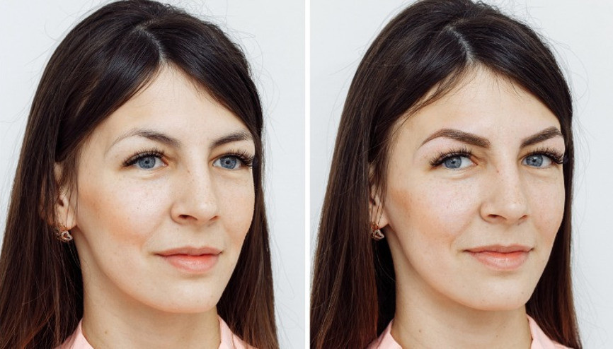 Kaş ve Kirpik Ekimi Nedir, Nasıl Uygulanır