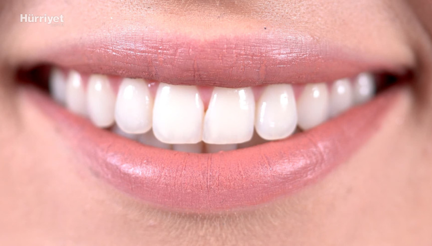 Dişlerin seni ele veriyor| Agresif misin, endişeli mi yoksa umursamaz mı