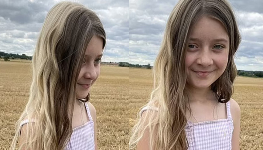 Bir gün sarışın bir gün esmer Saçını boyamıyor, nadir bir hastalığa sahip...