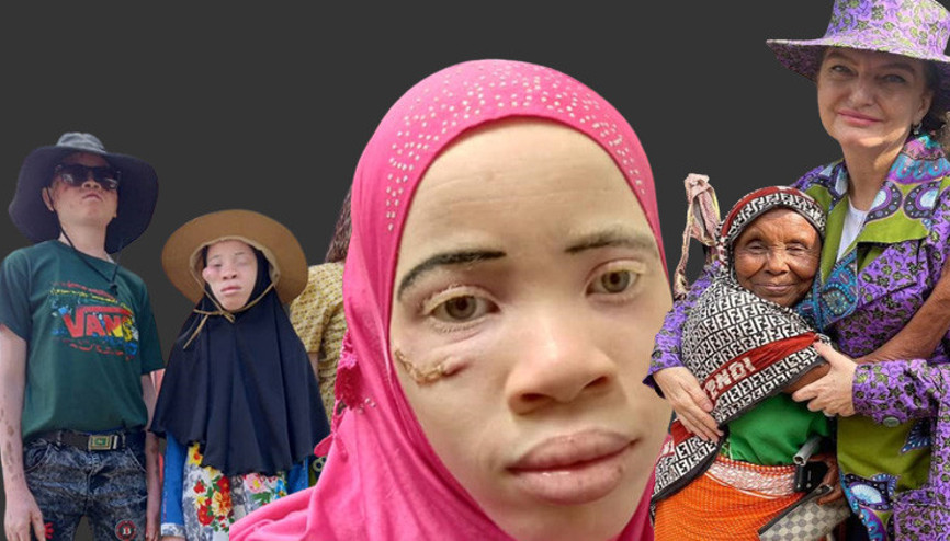 Siyah ülkenin lanetli beyazları Ve Afrikanın Türk Annesi...