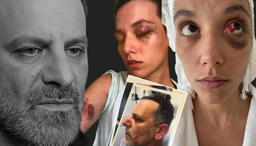 Ozan Güven ve Deniz Bulutsuz davasında Güvenin şoförü dinlendi: Ellerinde çizikler, bacaklarında kesikler vardı