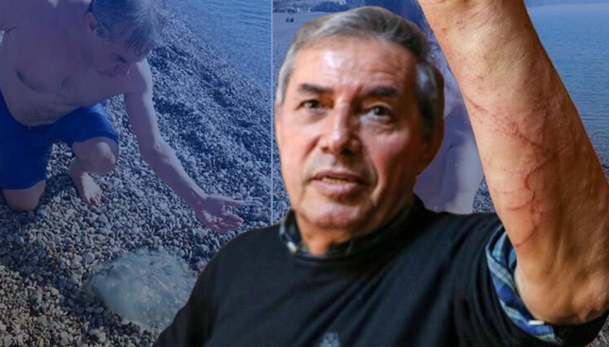 Profesörden uyarı: Denizanası çarpmasında tatlı su dökmeyin