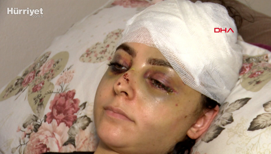 Sultangazide tayt dayağı: karısını hastanelik etti, serbest kaldı