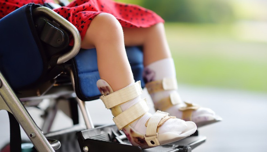 Serebral palsi nedir, belirtileri nelerdir Serebral palsi hastalığı nedenleri ve tedavisi Serebral palsi nedir, belirtileri nelerdir Serebral palsi hastalığı nedenleri ve tedavisi