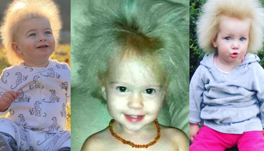 Takipçisinin attığı mesajla oğlunun hastalığı ortaya çıktı: Saçı taranamıyor