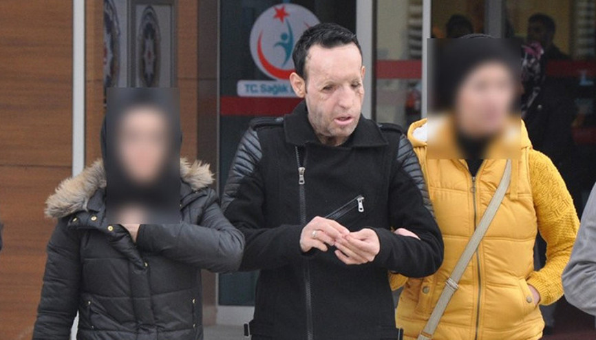 Uyuşturucu operasyonunda gözaltına alınanlar arasında yüz nakli yapılan Recep Sert de var Uyuşturucu operasyonunda gözaltına alınanlar arasında yüz nakli yapılan Recep Sert de var