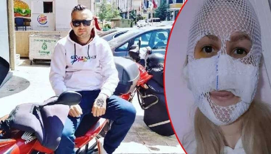 Sultanın yüzüne kimyasal madde atmıştı Soner Bolat için yakalama kararı çıkarıldı