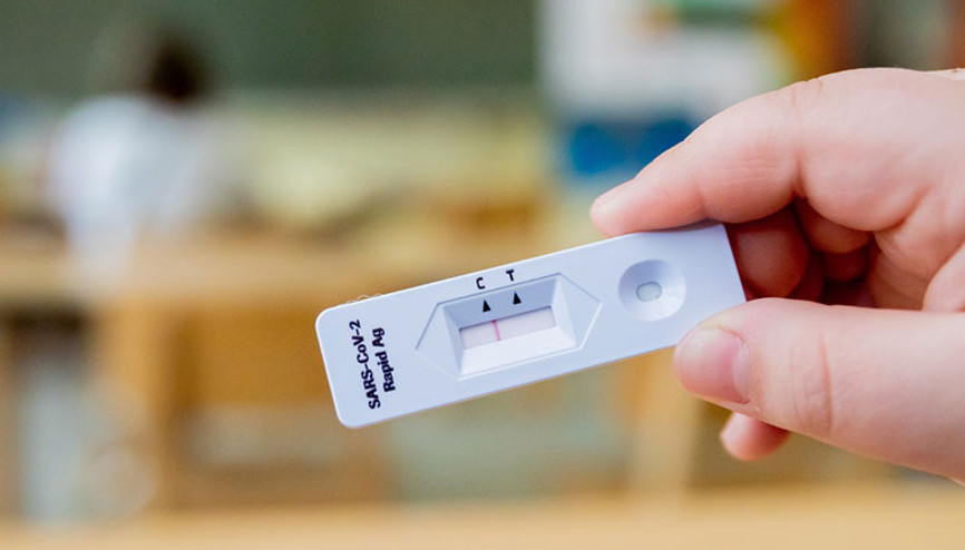 Ücretsiz testler 31 Mayıs’a kadar uzatılacak