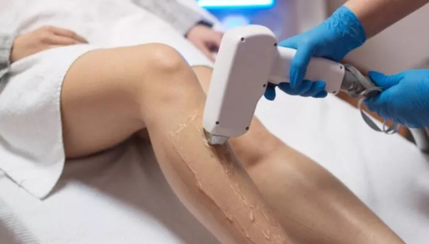 Oruçluyken lazer epilasyon yapılır mı Diyanet bilgisi Oruçluyken lazer epilasyon yapılır mı Diyanet bilgisi