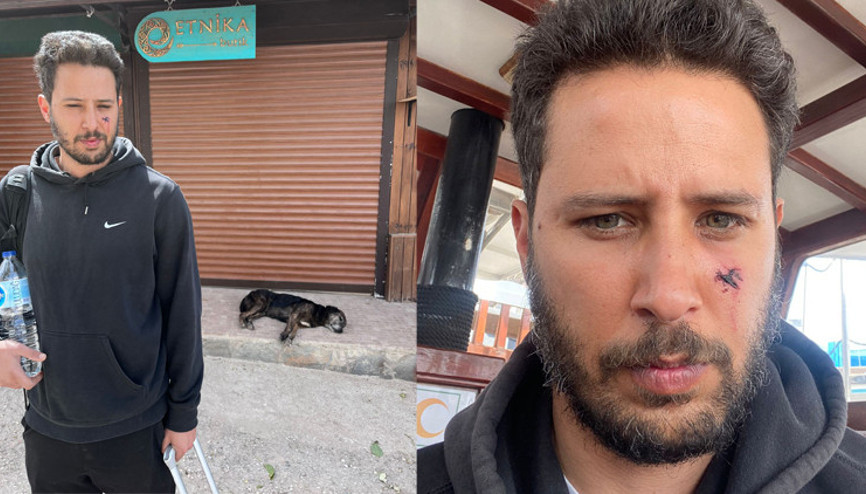 Tuan Tunalıyı köpek ısırdı