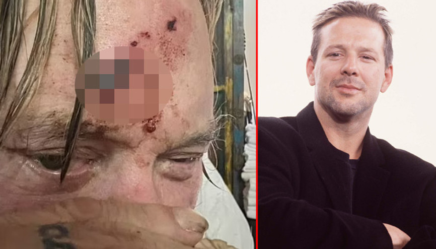 Eski günlerim geride kaldı: Ünlü oyuncudan kan revan paylaşım... Yüz hatlarımı bozup attılar demişti