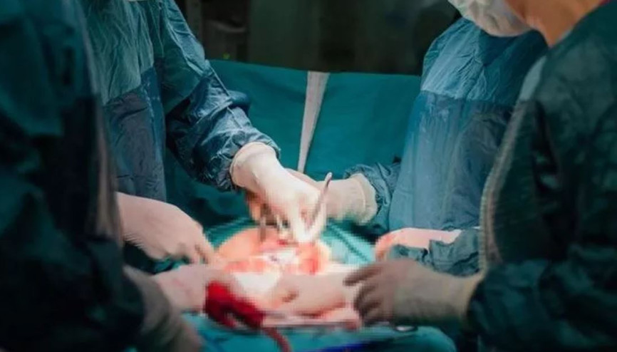 Miyom nedir Miyom ameliyatı nasıl yapılıyor