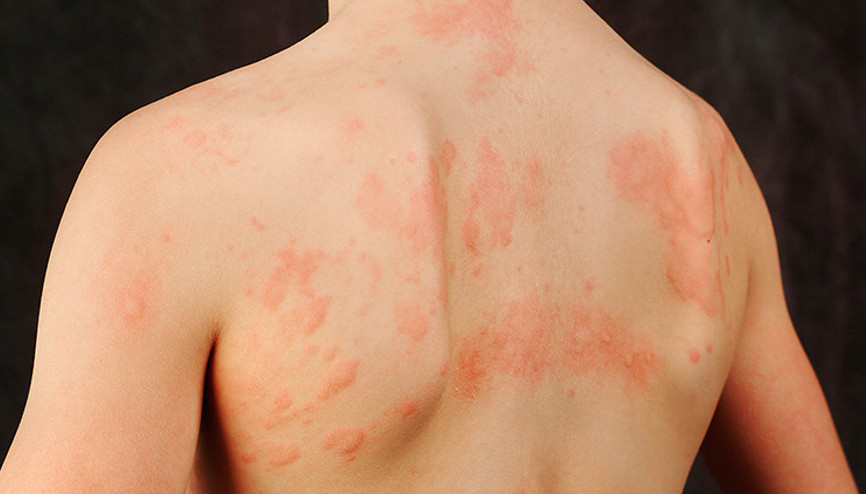 15 dakikadan fazla dışarıda duramıyor… ‘Okula yürüyerek gitmek onu öldürebilir