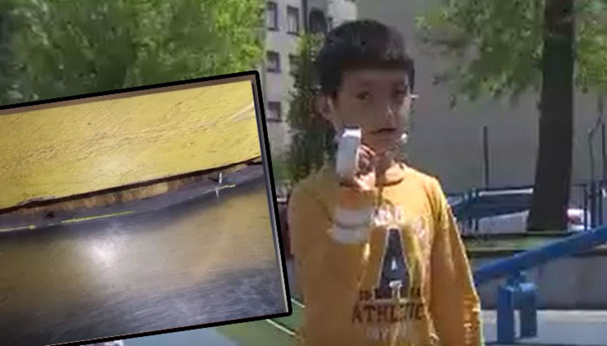 Parktaki ihmal çocuğa kabusu yaşattı: Kalemi zor tutuyorum