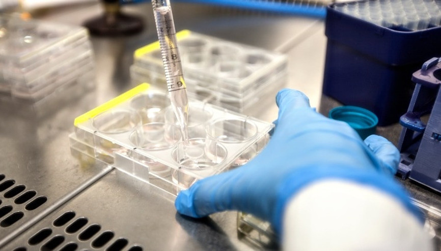 Sperm kalitesini belirleyen parametreler nelerdir, ne anlama gelir