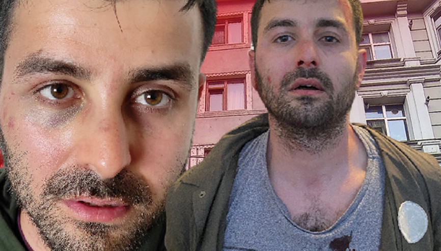 Futbolcu Veysel Sarının kardeşinin kiracıyı dövdüğü iddiası Beni evin içerisinden çekip darbetmeye başladı