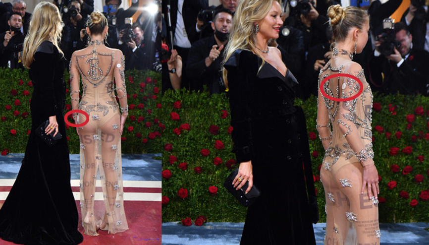 Hastalığını gizlemedi: Kırmızı halıya böyle çıktı