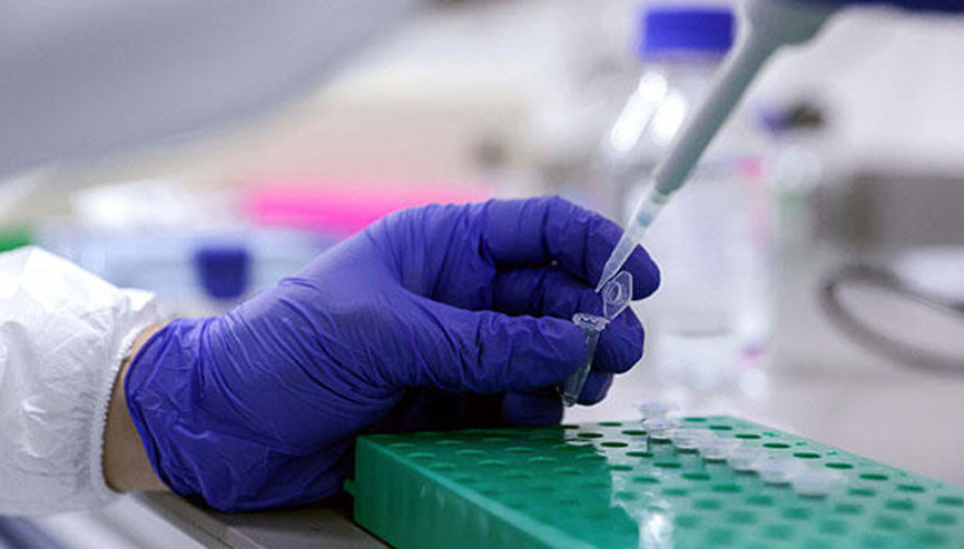 Son dakika... Sağlık Bakanlığından yeni karar: Ameliyat öncesi PCR testi kaldırıldı