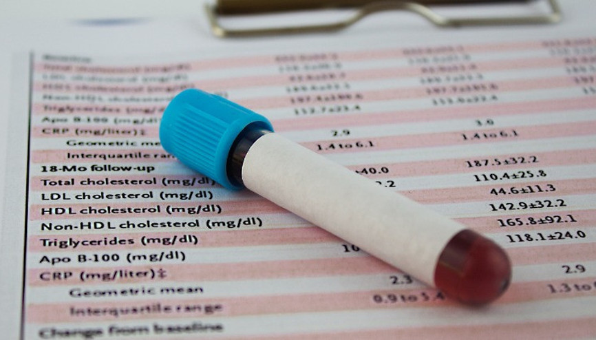 Hormon testi nasıl yapılır