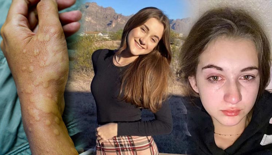 Dünyada 32 kişi bu hastalığı yaşıyor: Ağlamak bile yasak En son bir yıl önce su içtim