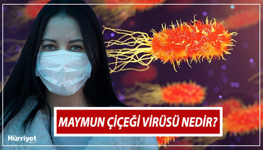 MAYMUN ÇİÇEĞİ VİRÜSÜ BELİRTİLERİ: Maymun çiçeği virüsü nedir, Türkiyede var mı DSÖden son dakika maymun çiçeği açıklaması