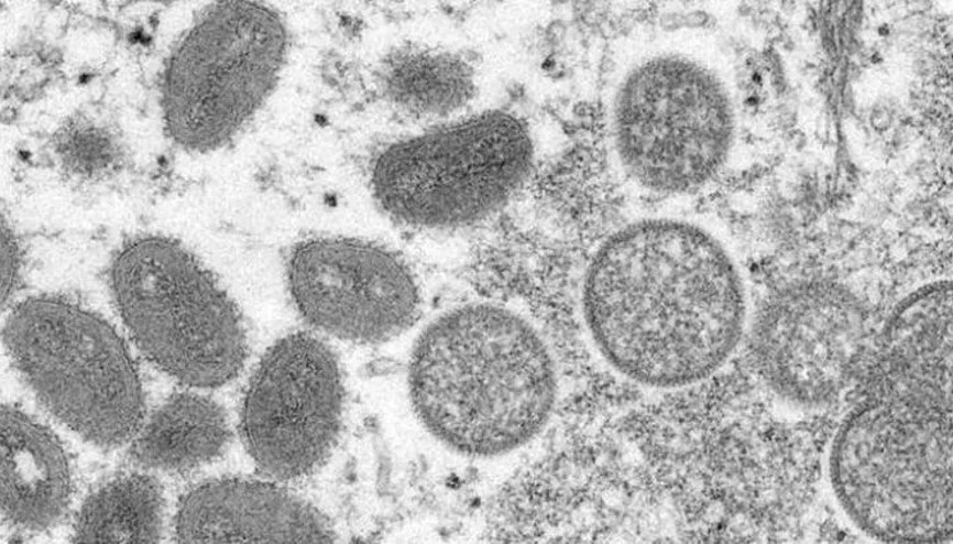 İngiltereden Maymun çiçeği uyarısı