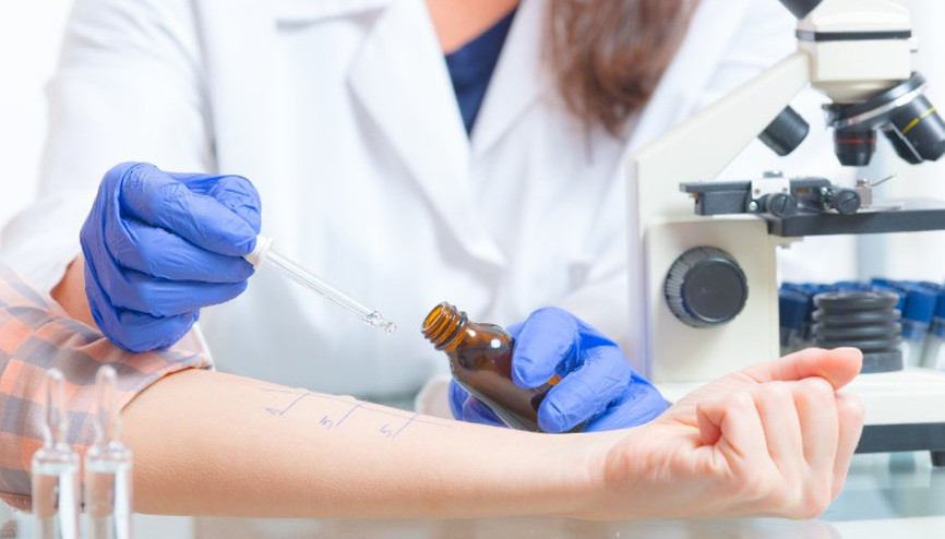 Alerji testi nasıl yapılır