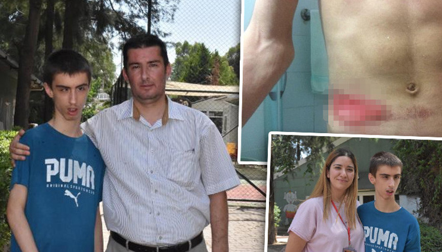 Hastanede saatlerce sedyede bağlı kaldı: Vücudunda yaralar oluştu