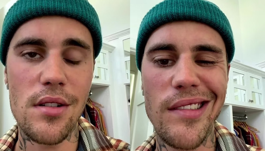 Justin Bieber, kötü haberi sosyal medyadan duyurdu: Beni dualarınızdan eksik etmeyin